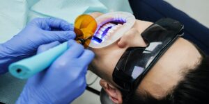 درمان ریشه ورتیکال کندنسشن