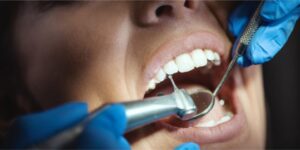 ترمیم دندان ترمیم دندان شکسته