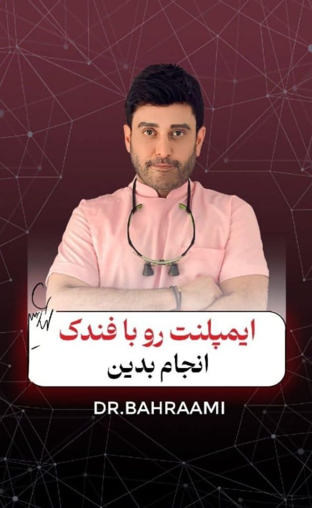 تفاوت روکش ایمپلنت تقلبی با اصل