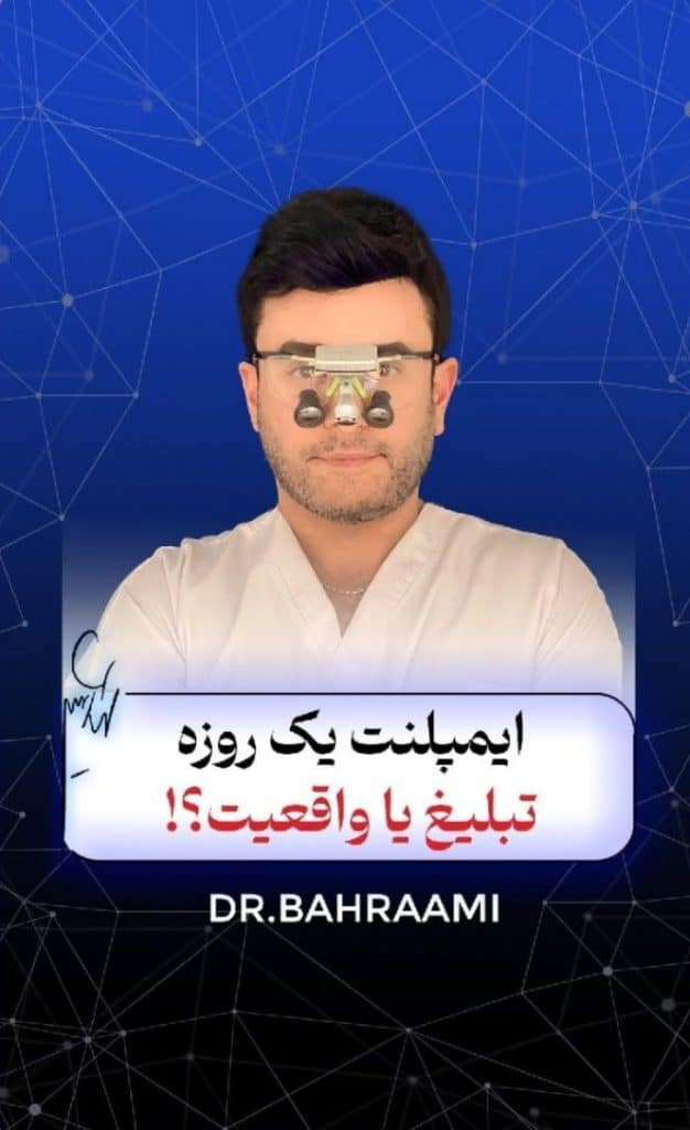ایمپلنت فوری و ایمپلنت یک‌روزه تبلیغ یا واقعیت ؟