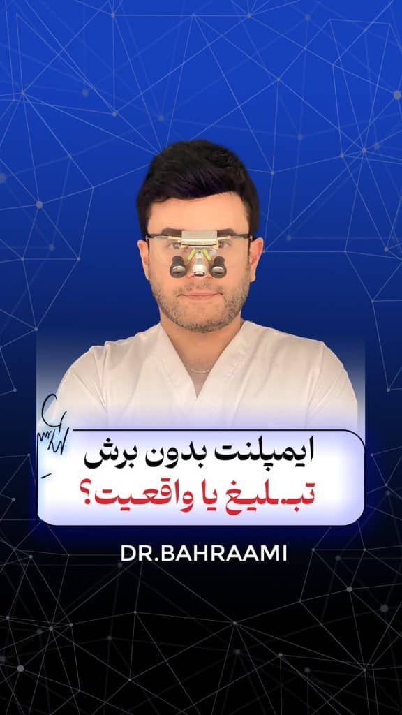 ایمپلنت بدون برش تبلیغ یا واقعیت ؟؟