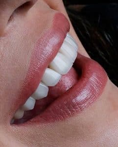 لمینیت سرامیکی