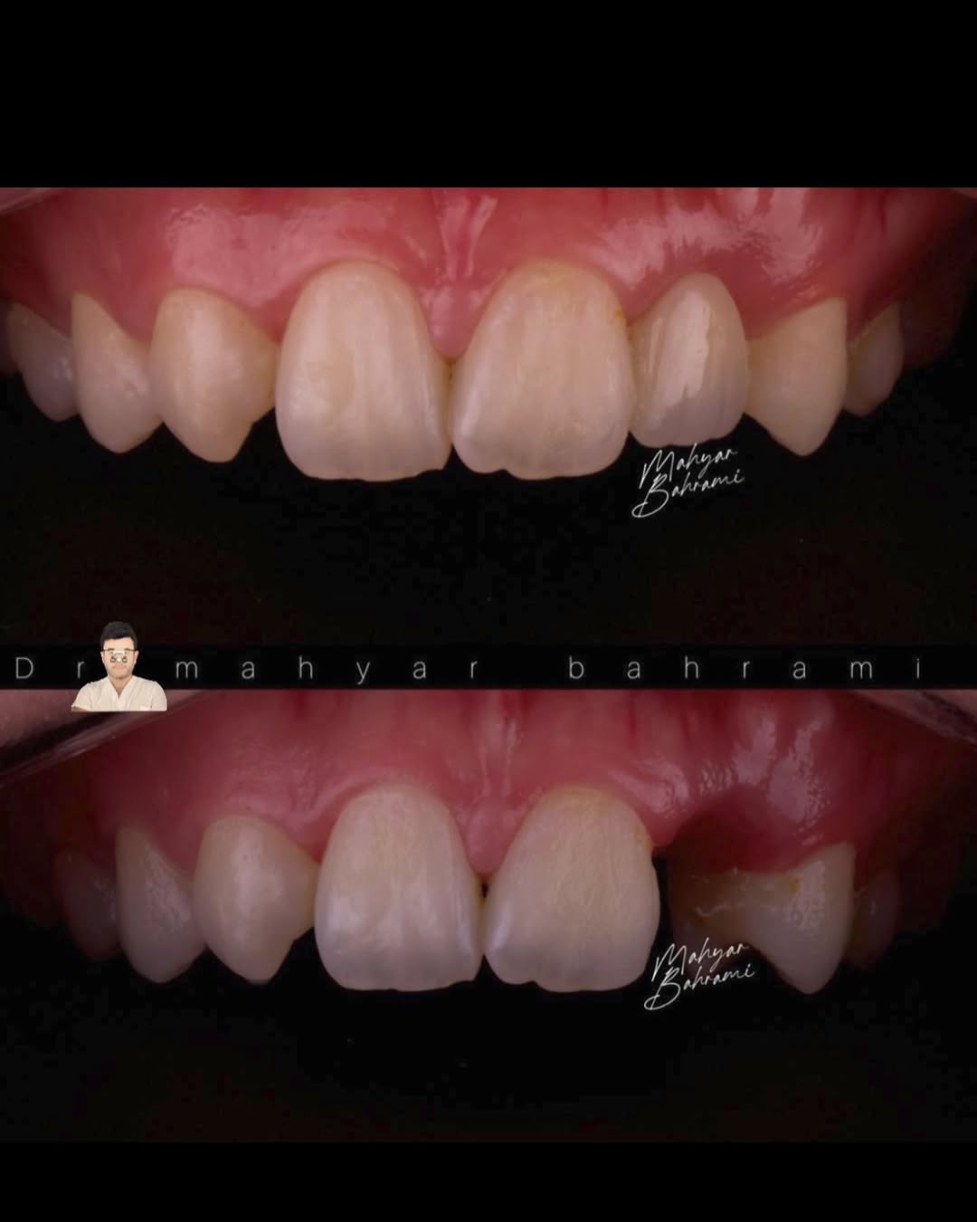 مریلند بریج